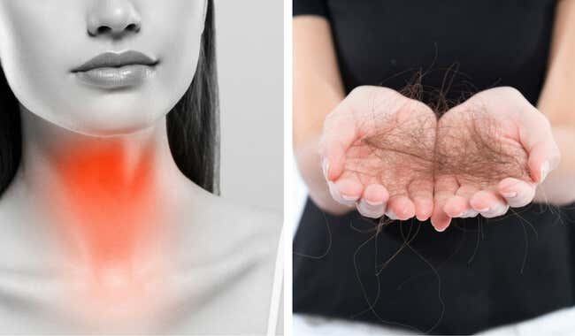 8 cosas que puedes hacer para combatir la pérdida del cabello por tiroides