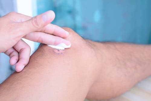 Heridas que tardan en cicatrizar