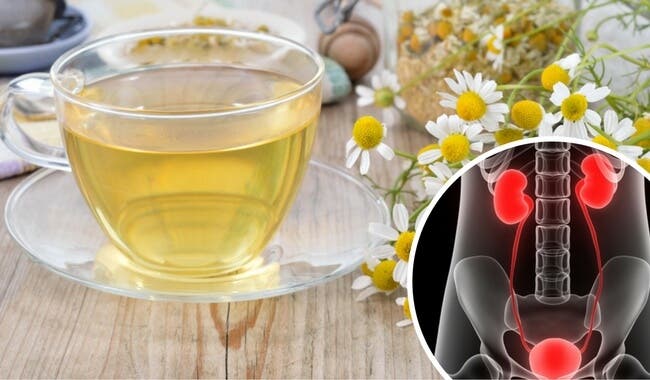Infusión de manzanilla para aliviar las infecciones del tracto urinario