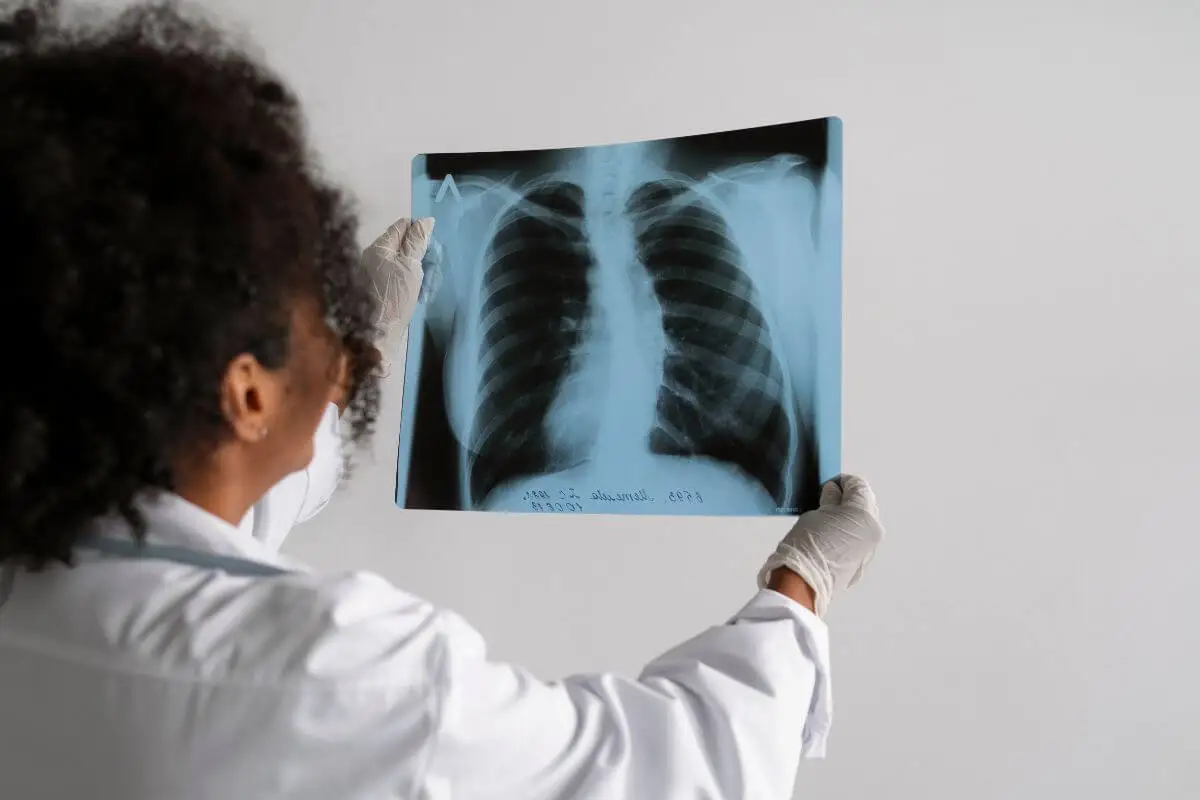 Pulmones