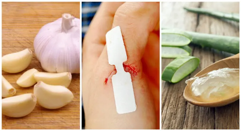 10 antisépticos naturales para tratar las heridas superficiales