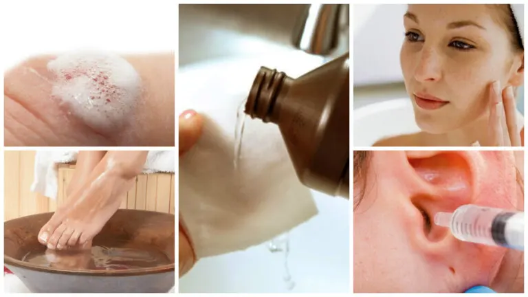 9 remedios caseros con agua oxigenada que debes conocer