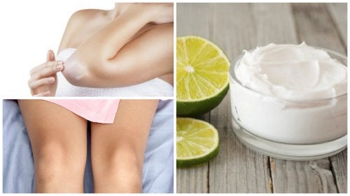 Crema de leche y vitamina E para aclarar los codos y las rodillas