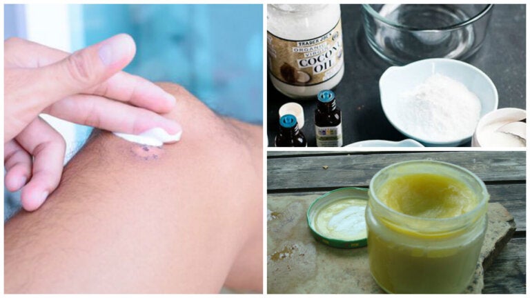 Cómo preparar un ungüento antibiótico para tratar las heridas superficiales