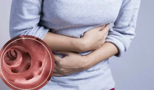 Descubre cómo aliviar la diverticulitis naturalmente