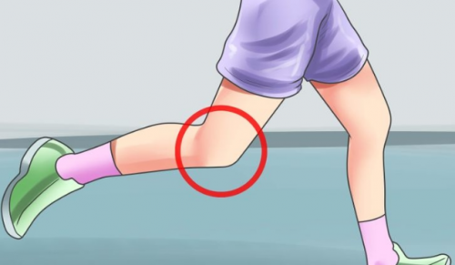 Síndrome de Sinding rodilla