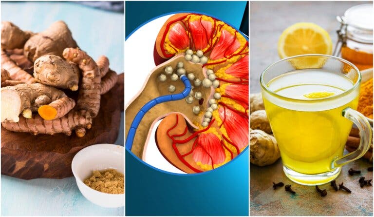 Té de jengibre y cúrcuma: ¿ayuda a combatir las piedras en los riñones?