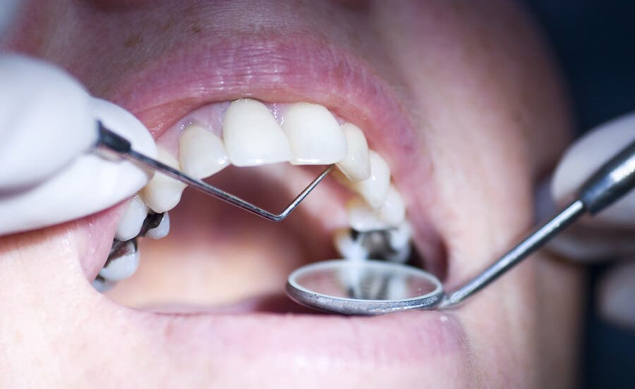El jugo de arándanos ayuda a cuidar la salud dental