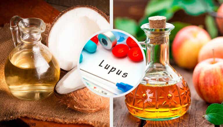Lupus: ¿hay remedios que ayudan a controlarla?