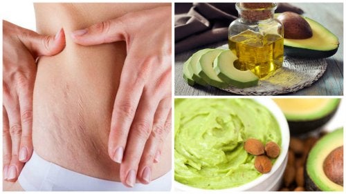 3 cremas caseras con aguacate para disminuir las estrías