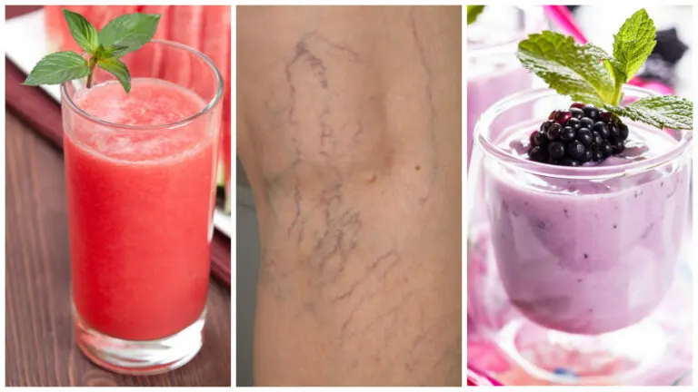 5 deliciosos licuados para combatir las várices naturalmente