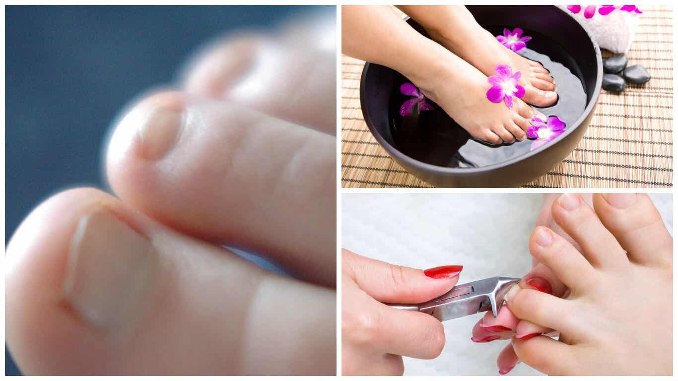 Cuidados en los pies: cortar las uñas y baños con agua.