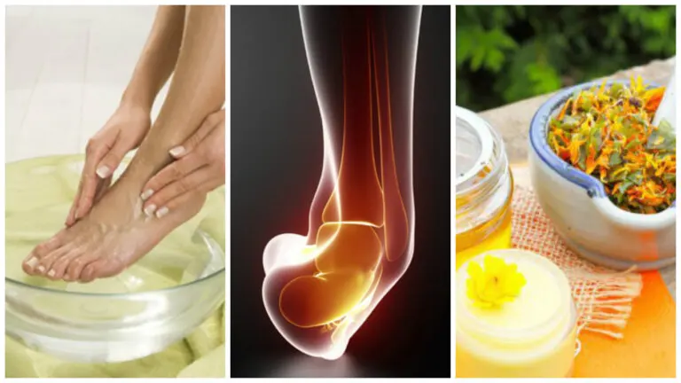 9 remedios caseros para aliviar el esguince de tobillo