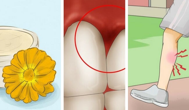 8 sorprendentes beneficios de la caléndula que seguro no conocías - Mejor  con Salud