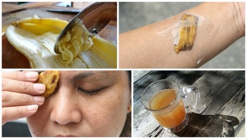 8 usos medicinales de la cáscara de banana