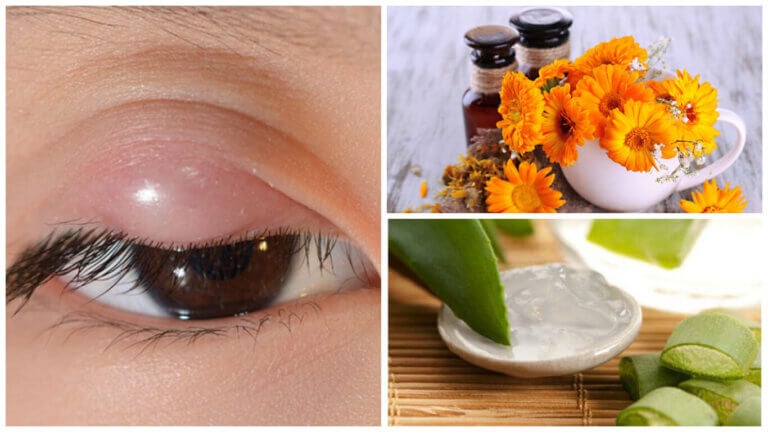 Cómo aliviar los orzuelos con estos 7 remedios naturales