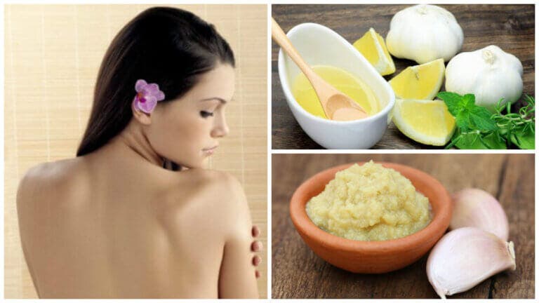 Dile adiós a las espinillas de la espalda con este remedio de ajo y limón