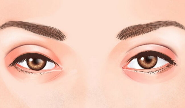 Lo Que Dicen Tus Ojos Sobre Tu Salud — Mejor Con Salud 1612