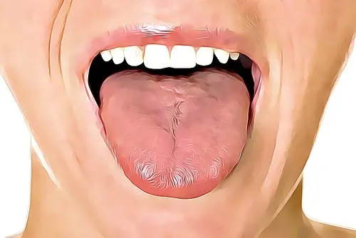 Lingua spaccata