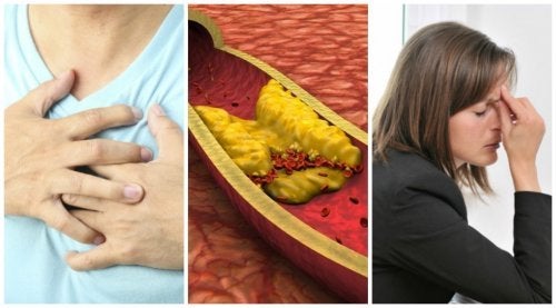 10 síntomas de colesterol alto que no debes ignorar