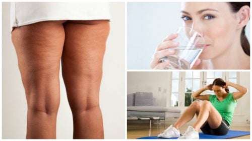 6 cosas que debes hacer antes de iniciar un tratamiento contra la celulitis