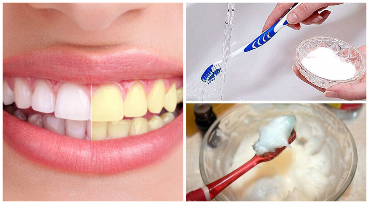 Blanquear tus dientes: 6 trucos con bicarbonato sódico - Mejor con Salud