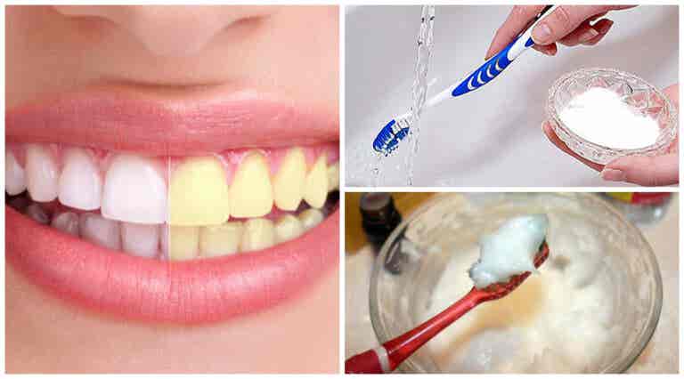 Blanquear tus dientes: 6 trucos con bicarbonato sódico