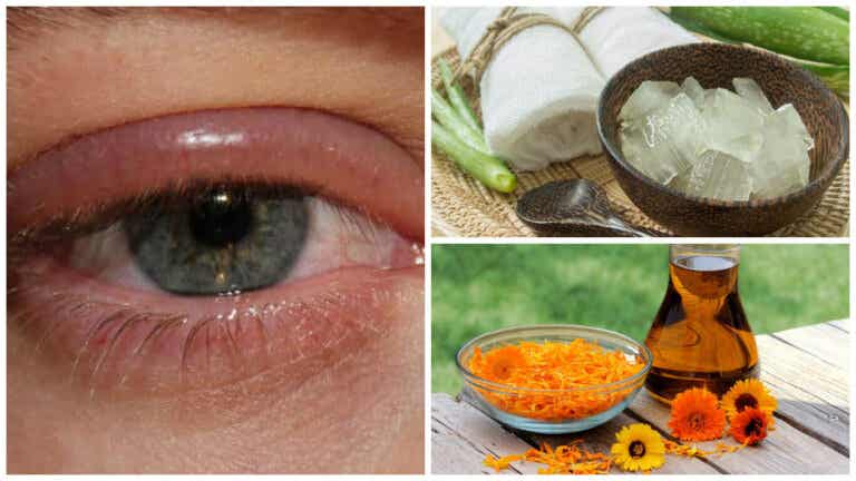Combate las infecciones en los ojos con alguno de estos 9 remedios