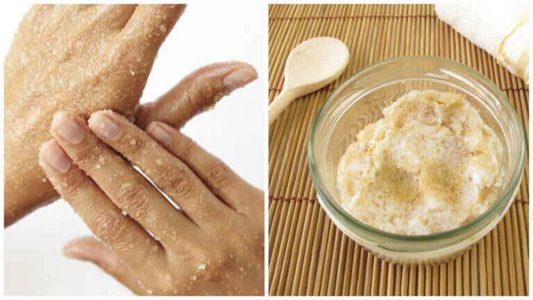 Cómo preparar un exfoliante natural de azúcar para suavizar las manos