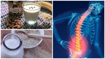 Los 6 mejores remedios naturales para prevenir la osteoporosis