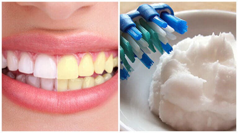 Prepara una pasta dental blanqueadora para eliminar la placa y las bacterias