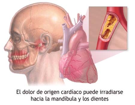 el dolor mandibular puede producirse por distintas causas