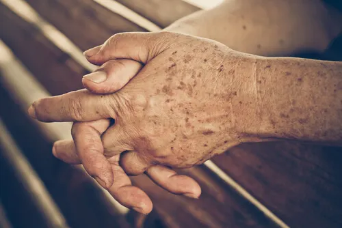 4 remedios caseros que evitan las manchas de la edad