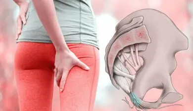 Dolor en el perineo o neuralgia del pudendo: una dolencia muy común