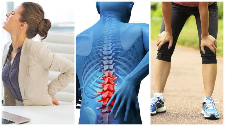 7 síntomas que nos alertan de una posible lumbalgia