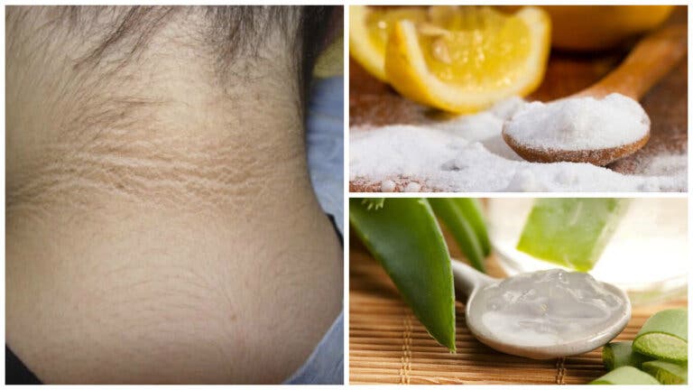 5 tratamientos cosméticos para aclarar el cuello oscuro