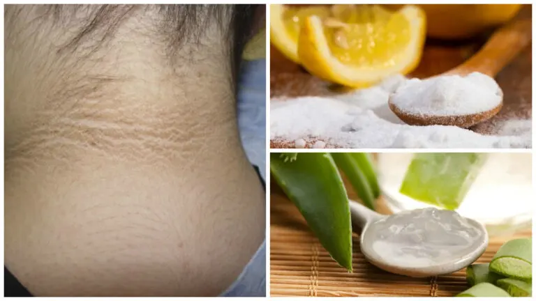 5 tratamientos cosméticos para aclarar el cuello oscuro