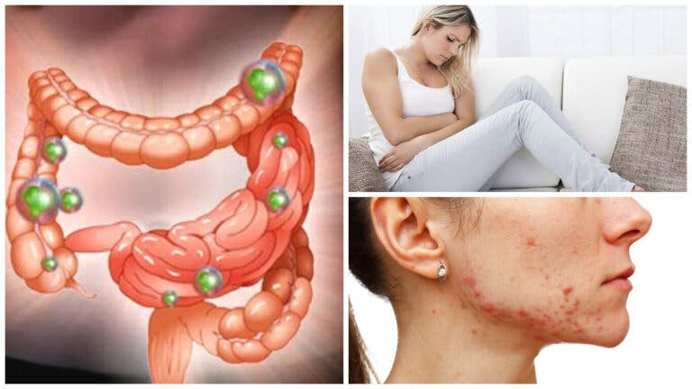 6 problemas que te aquejan cuando las bacterias intestinales están fuera de control