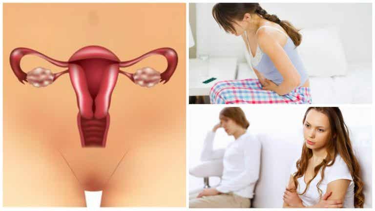7 cosas que debes saber sobre el síndrome de ovario poliquístico