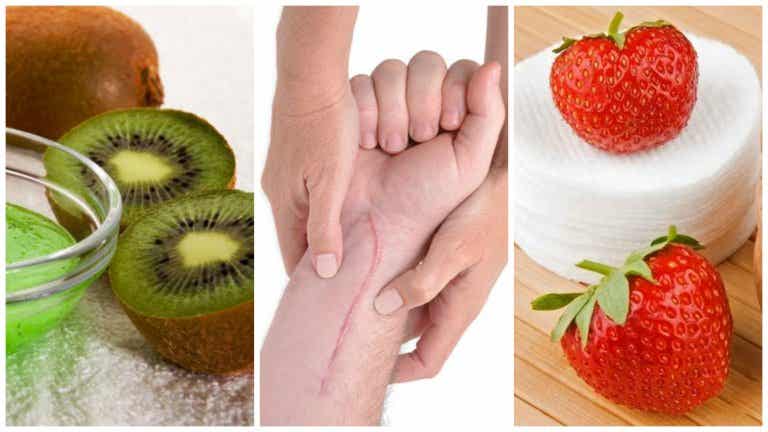 5 mascarillas de frutas  para acelerar la cicatrización de tu piel