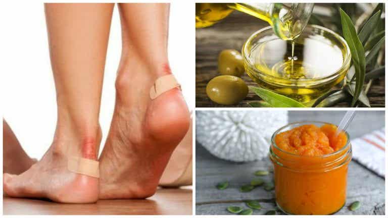 Alivia las ampollas de los pies con estos 7 remedios naturales