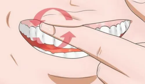 8 remedios para combatir encías inflamadas