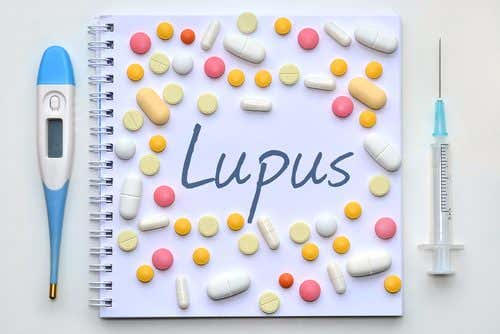 Es posible reconocer el lupus