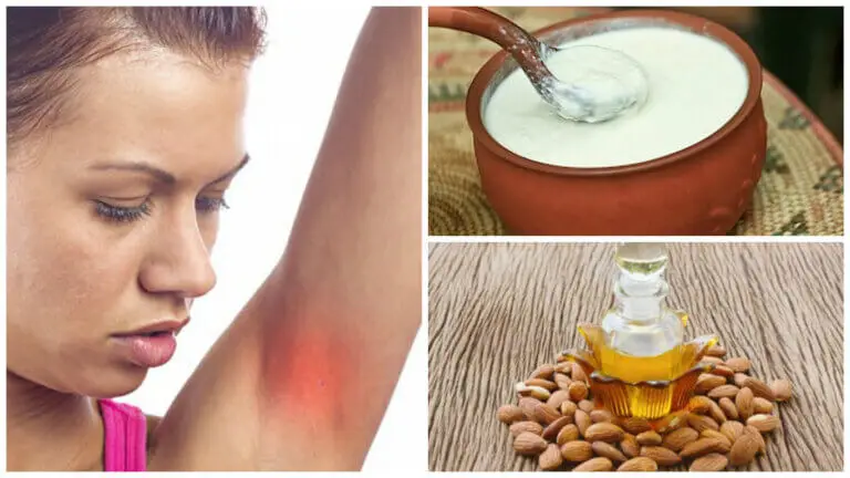 Axilas irritadas: los 7 mejores remedios caseros