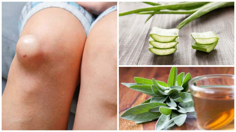 5 remedios antiinflamatorios para el líquido en la rodilla