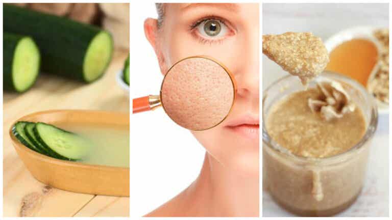 Sella los poros dilatados de tu piel con estos 5 remedios naturales