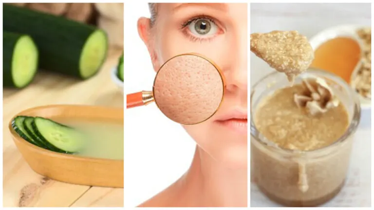 Sella los poros dilatados de tu piel con estos 5 remedios naturales