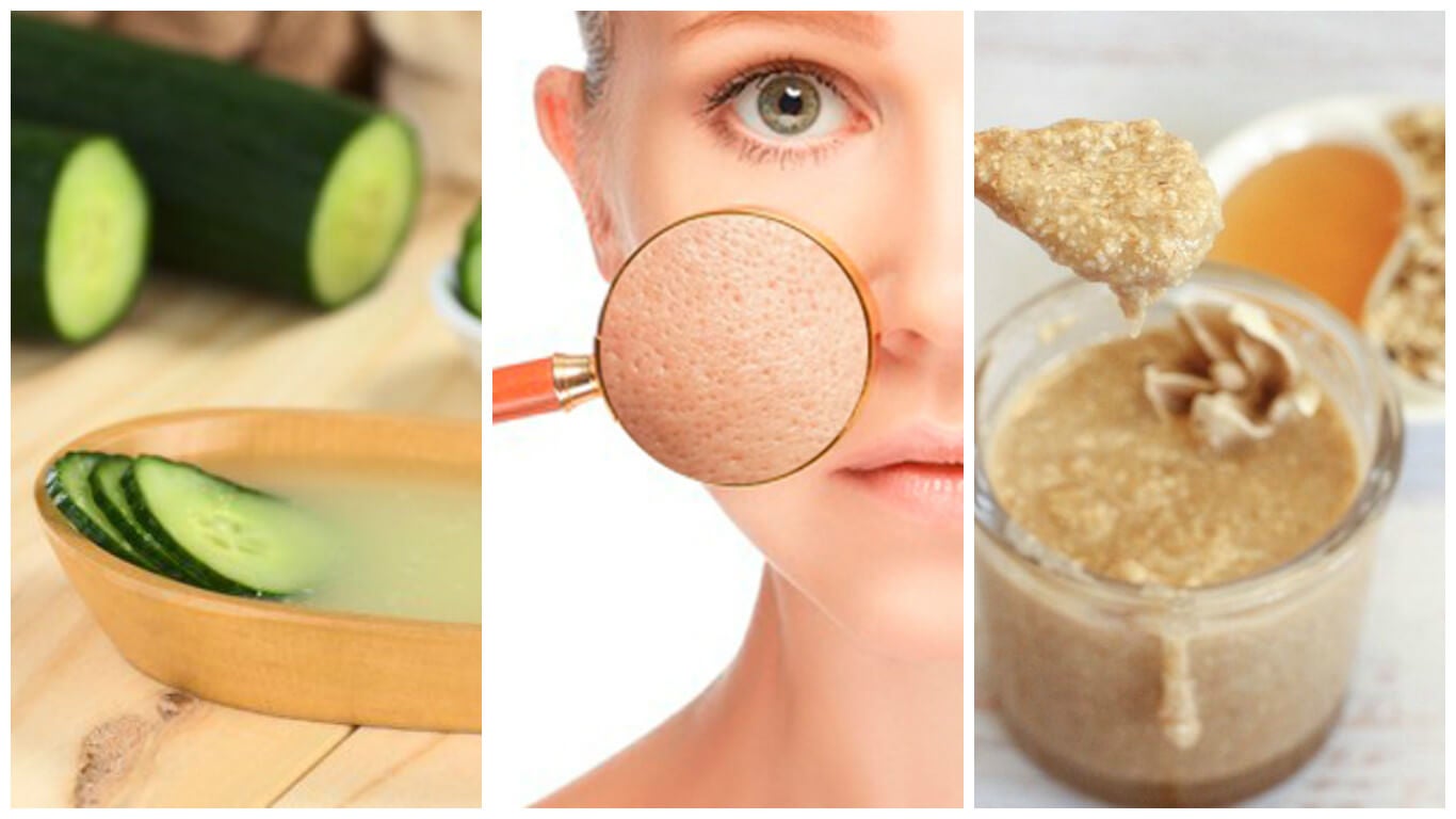 Sella los poros dilatados de tu piel con estos 5 remedios naturales - Mejor  con Salud