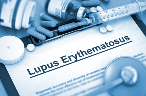 Cuidado personal de los pacientes con lupus