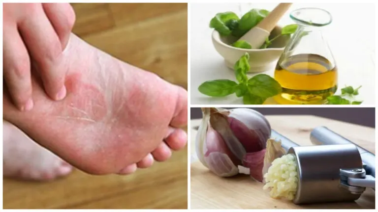 Baño casero para tratar los hongos en los pies